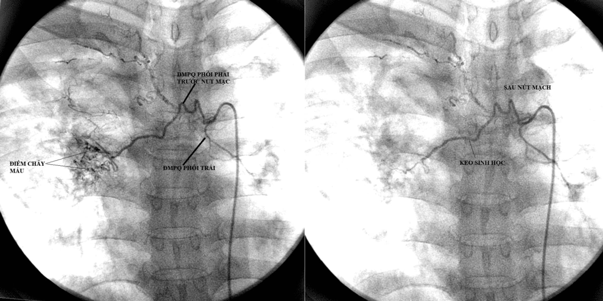 17.8.2025 Ho za mau.png