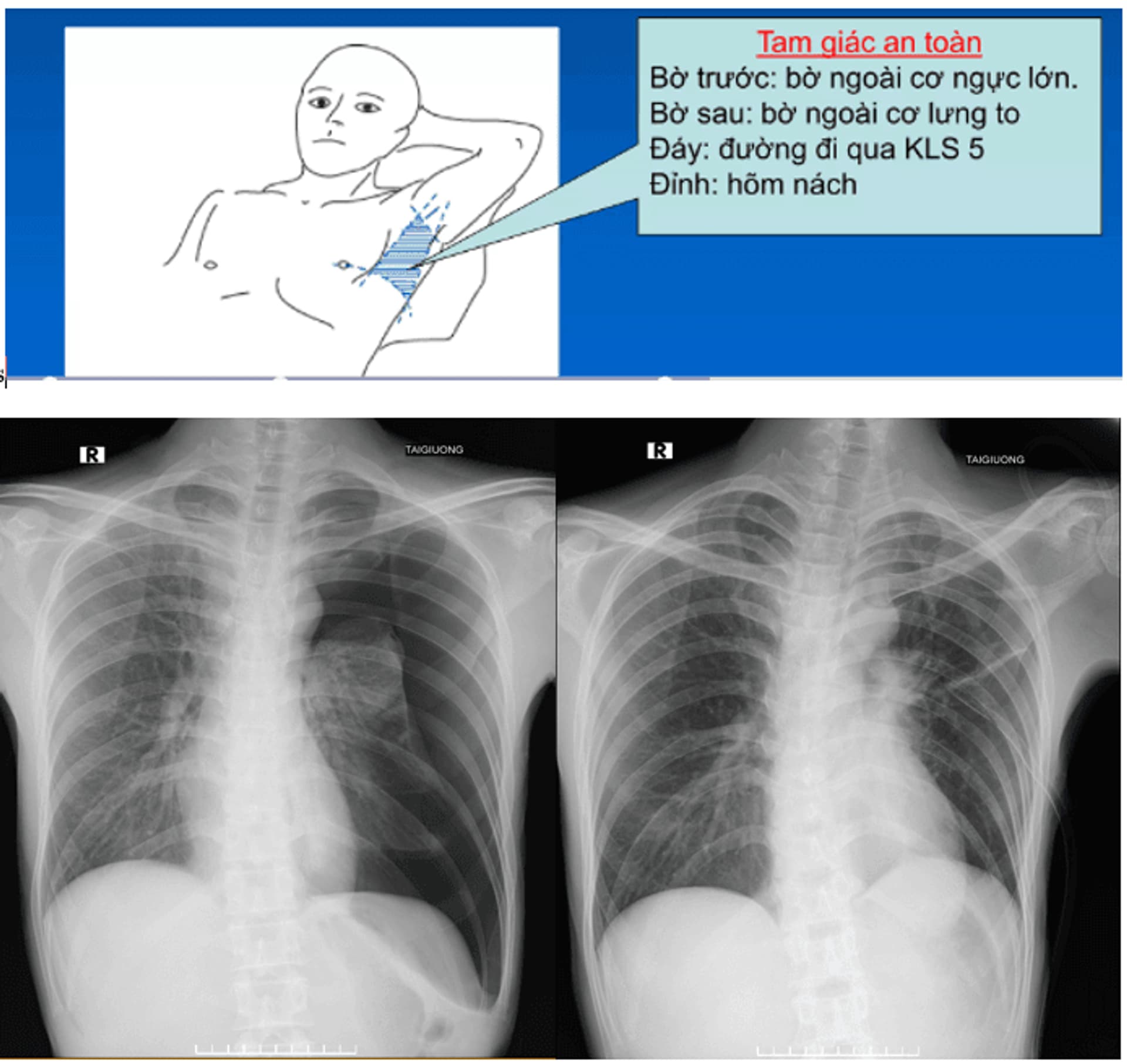 17.8.2025 tHỦ THUẬT 0.png