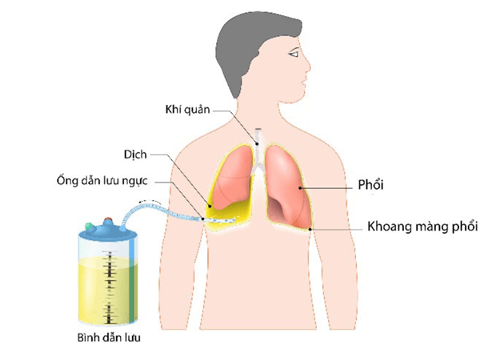 17.8.2025 tHỦ THUẬT.png