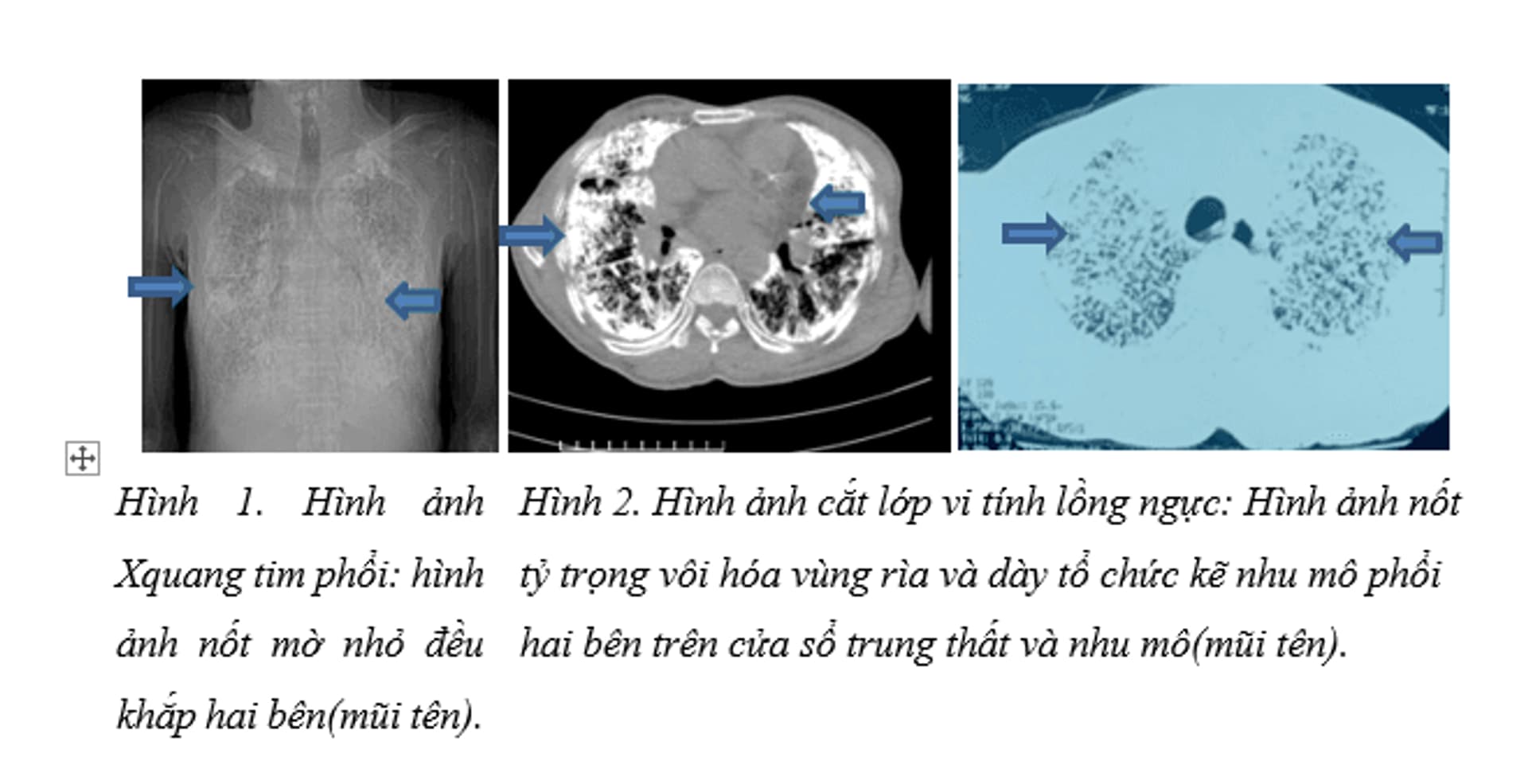 2025-10-30 115458 anh 1.png