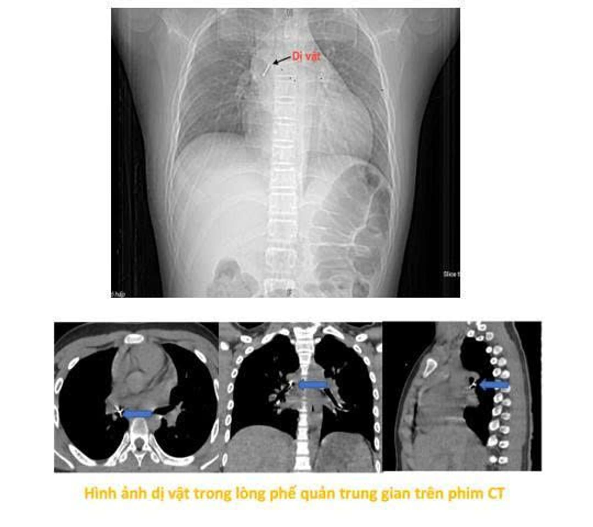 22.10.2025 Anh 1.jpg