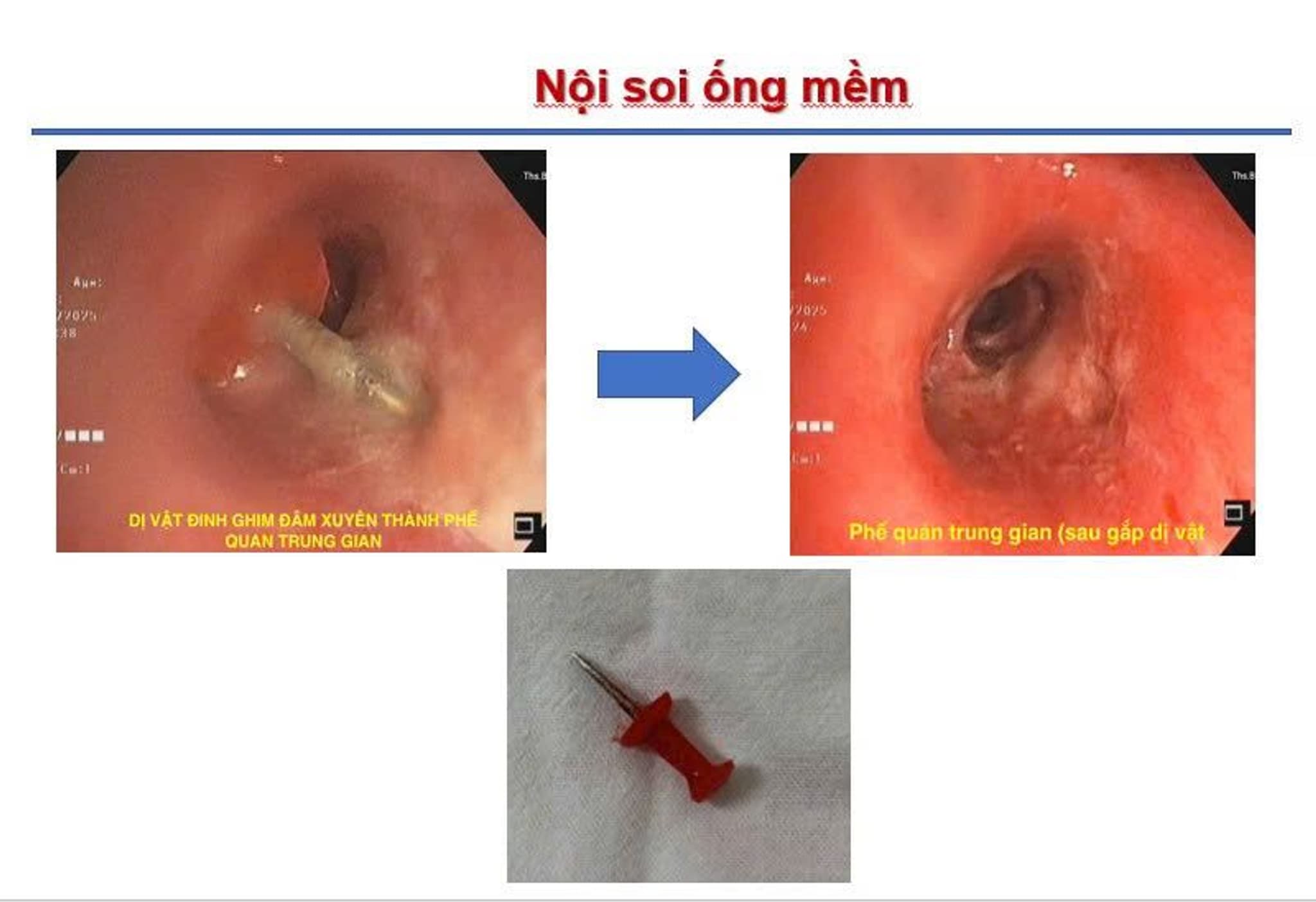 22.10.2025 Anh 2.jpg