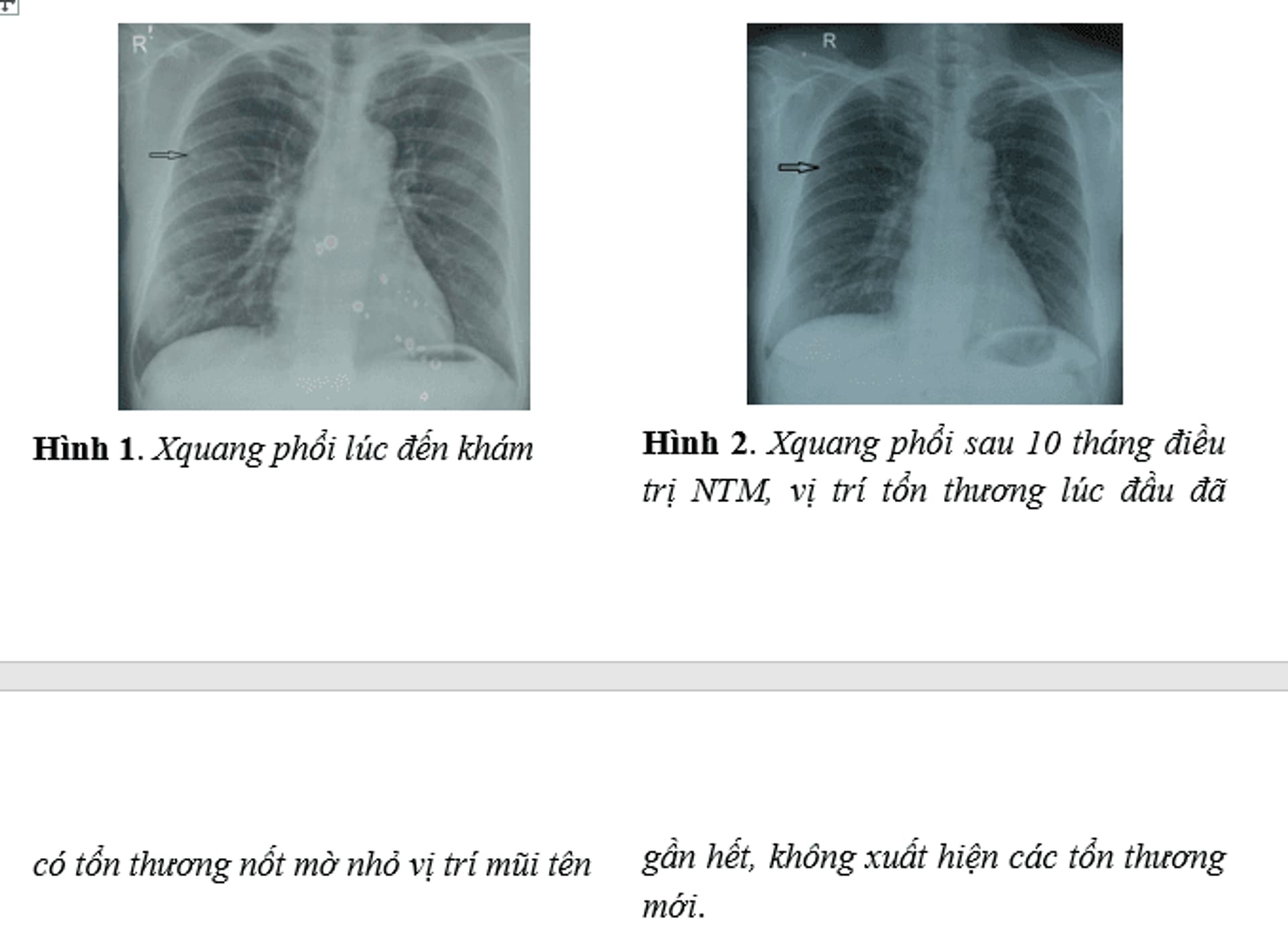 26.8.2025 Bai biet diẻn hình bài 1.png