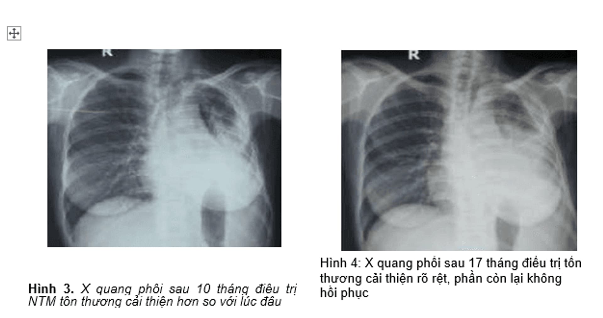 26.8.2025 Bai biet diẻn hình bài 2 anh 2.png
