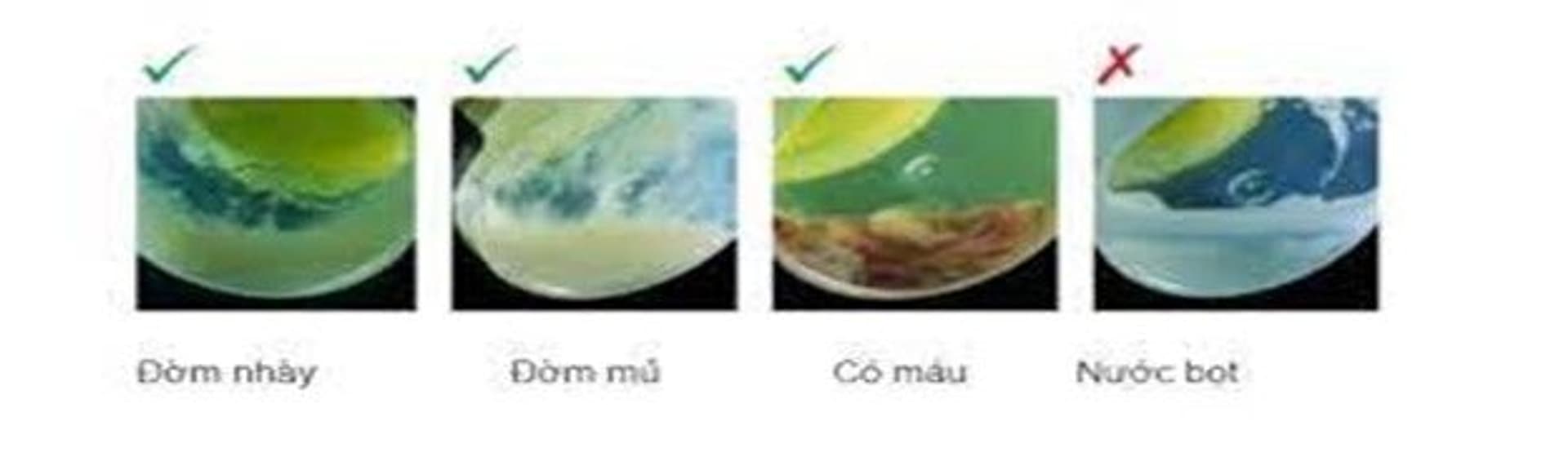 Bài 9 anh 2 lao.jpg