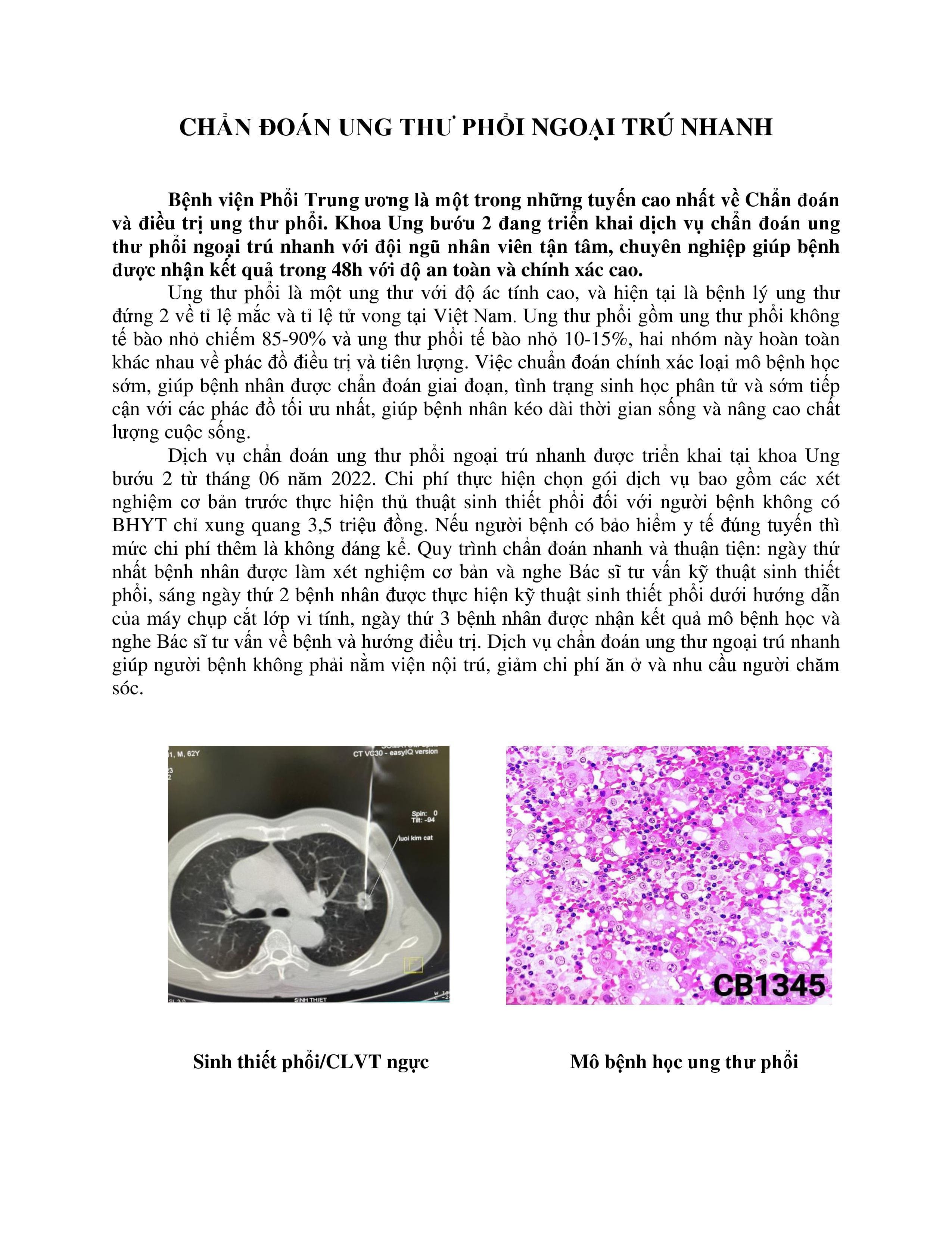CHẨN ĐOÁN UNG THƯ PHỔI NGOẠI TRÚ NHANH_1.jpg