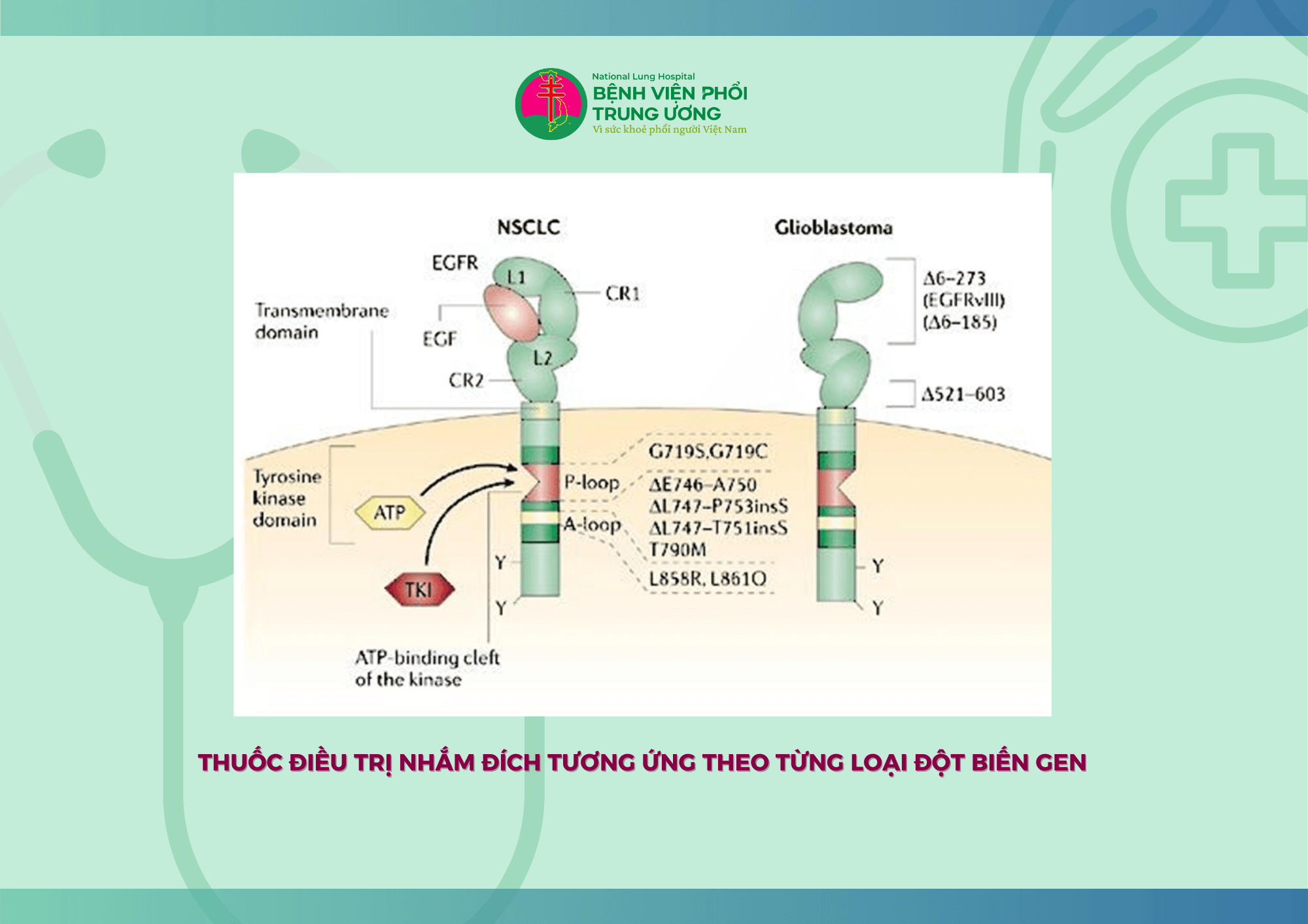 ĐIỀU TRỊ ĐÍCH TRONG UNG THƯ PHỔI KHÔNG TẾ BÀO NHỎ  GIAI ĐOẠN DI CĂN TIẾN XA (3).png