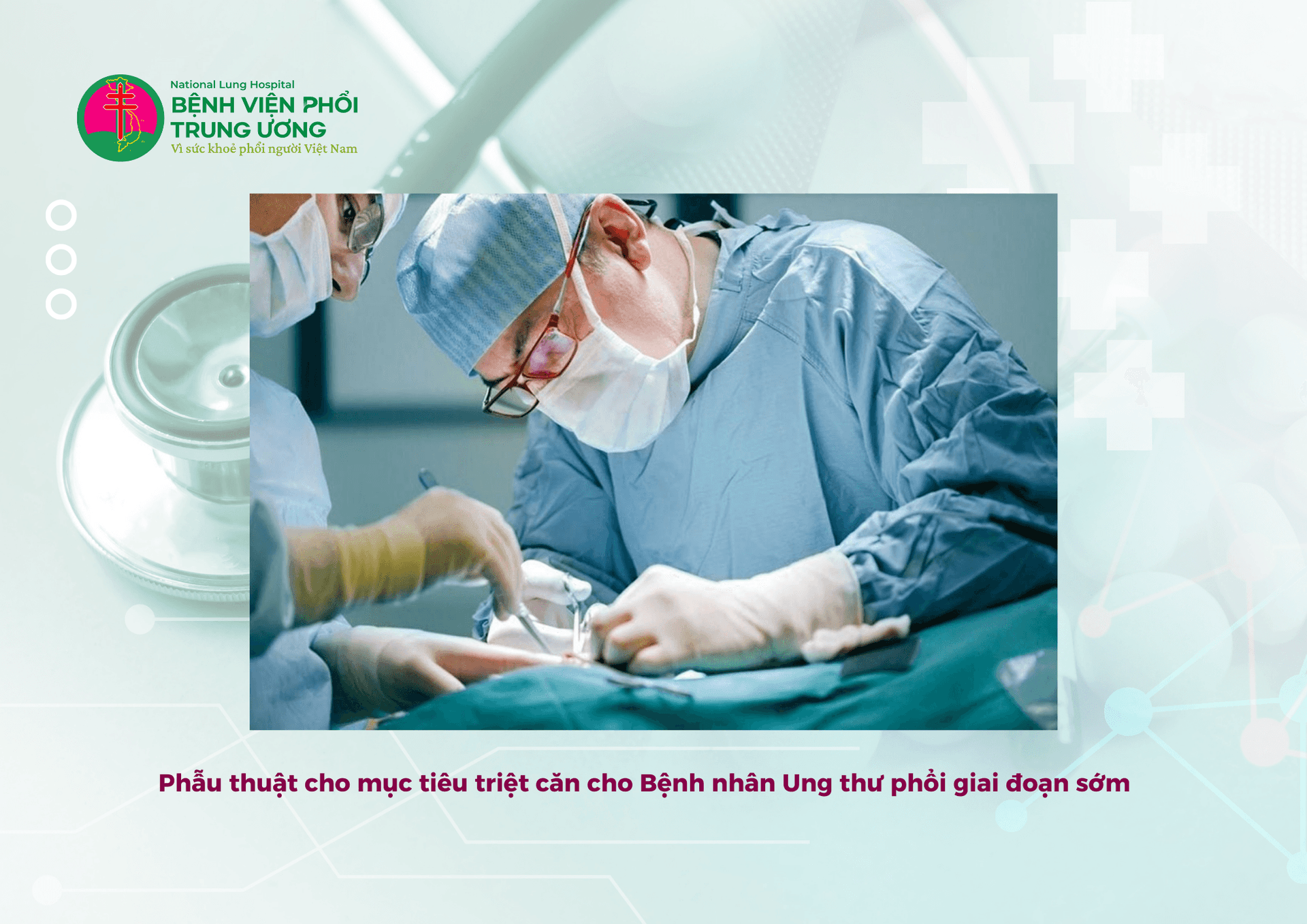 PHẪU THUẬT CHO MỤC TIÊU TRIỆT CĂN UNG THƯ PHỔI (3).png