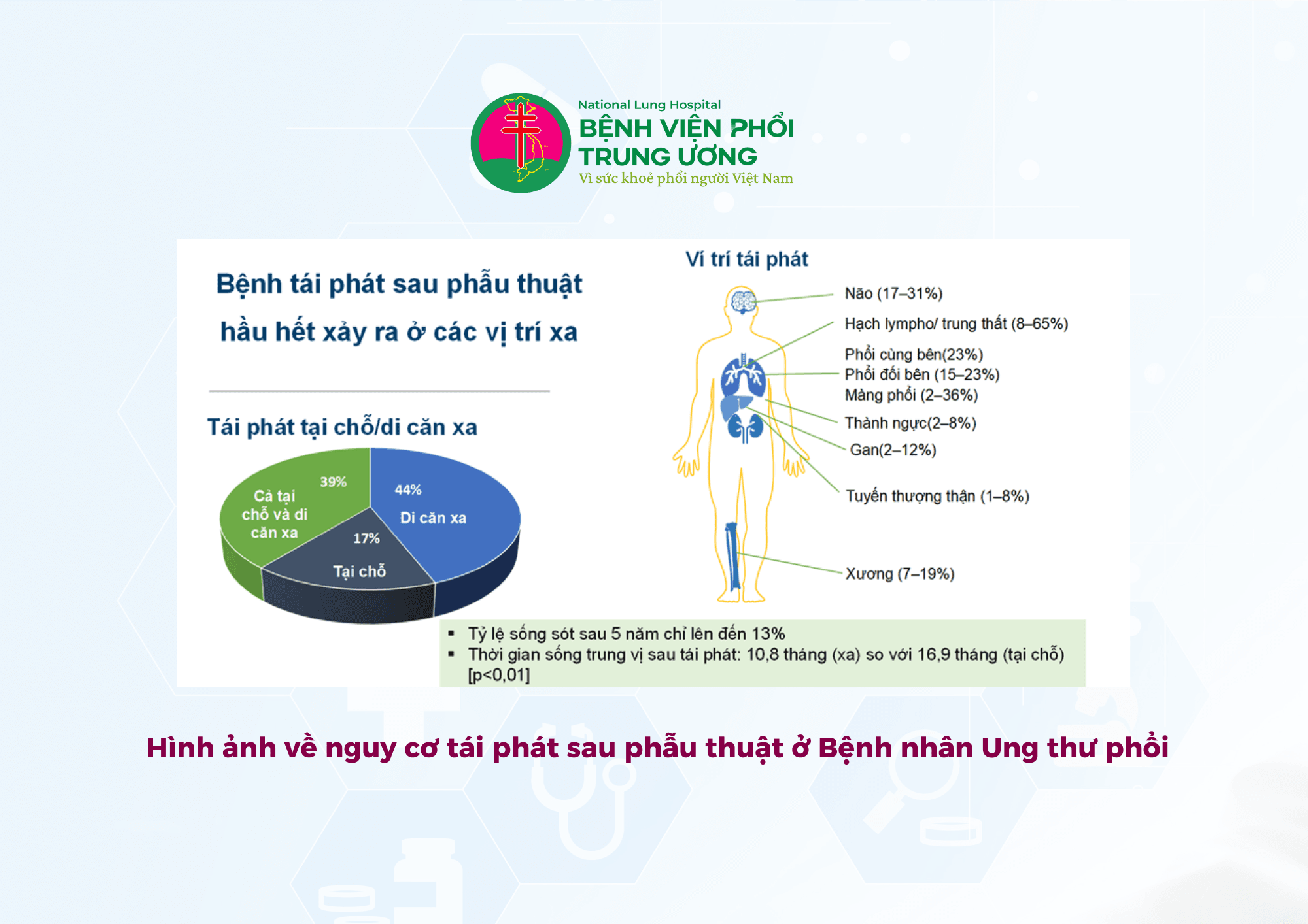 PHÒNG NGỪA TÁI PHÁT SAU PHẪU THUẬT UNG THƯ PHỔI  CHÚNG TA PHẢI LÀM GÌ (2).png