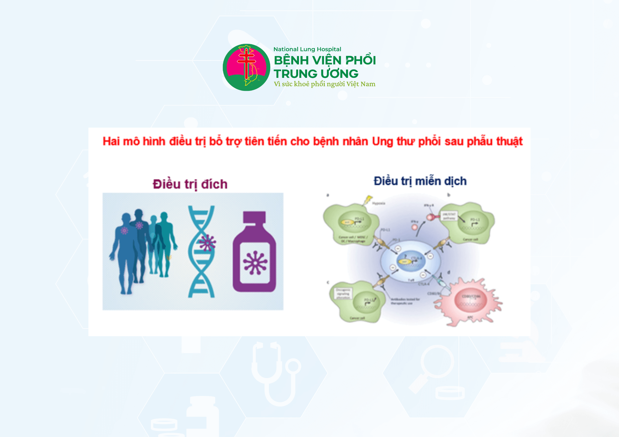 PHÒNG NGỪA TÁI PHÁT SAU PHẪU THUẬT UNG THƯ PHỔI  CHÚNG TA PHẢI LÀM GÌ (3).png